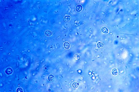   Cryptosporidium：一個躲藏在水中的微觀幽靈，它會在你的腸道中悄悄地作祟嗎？