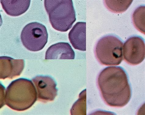  Plasmodium 潛藏於紅血球之中，這隻微小寄生蟲是造成瘧疾的元兇！