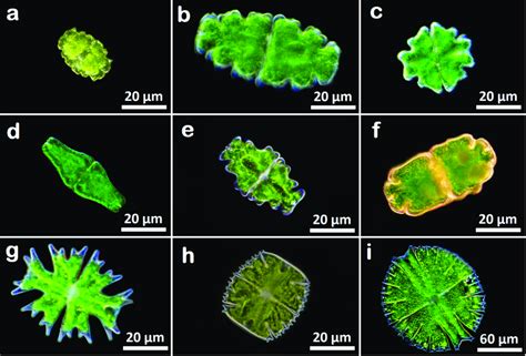  Xenophrydae: 獨特的原生生物，擁有令人驚嘆的偽足運動能力！